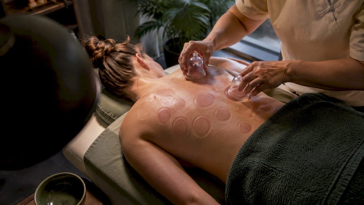 $50–$100 per Session: U.S. Cupping Therapy Costs and Verified Providers